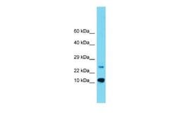 C8orf31 Rabbit anti-Human, Polyclonal, Novus Biologicals:Antibodies:Primary